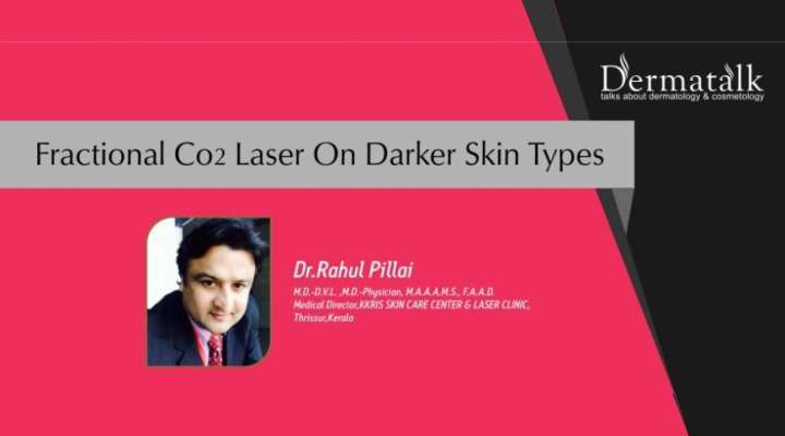 Fractional Co2 Laser On Darker Skin Types