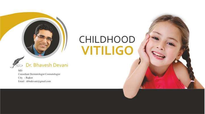 Childhood Vitiligo