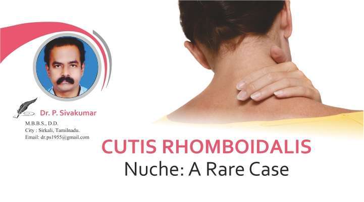 Cutis Rhomboidalis Nuche: A Rare Case