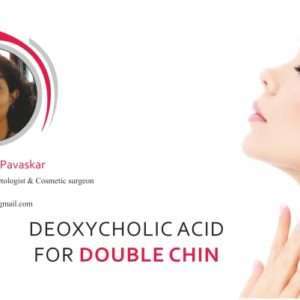 Deoxycholic Acid for Double Chin