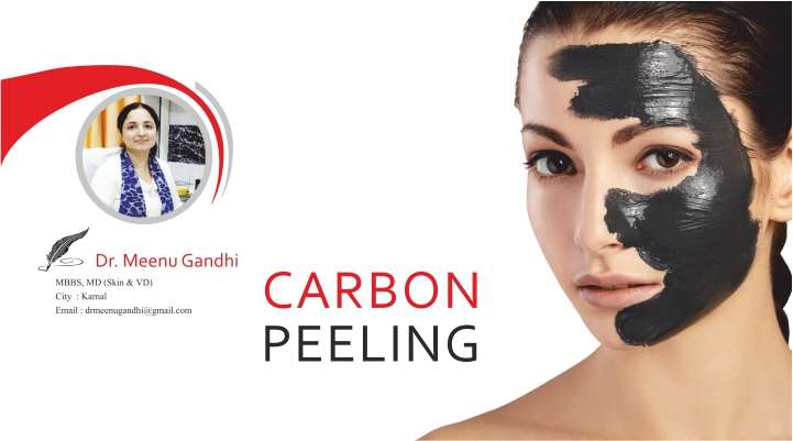 Carbon Peeling