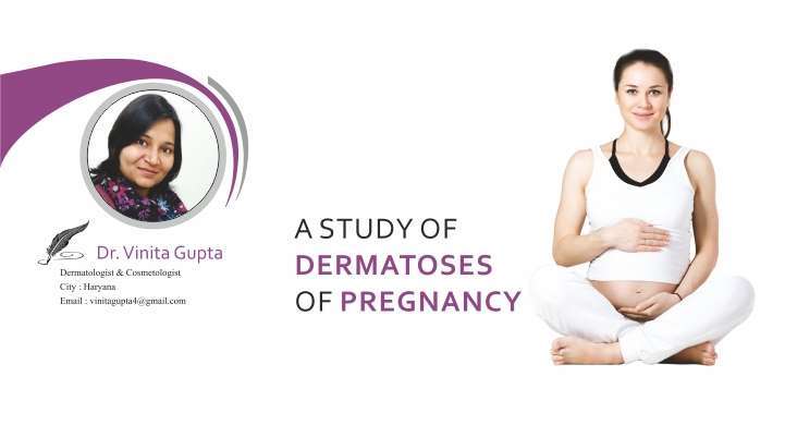 A Study of Dermatoses of Pregnancy
