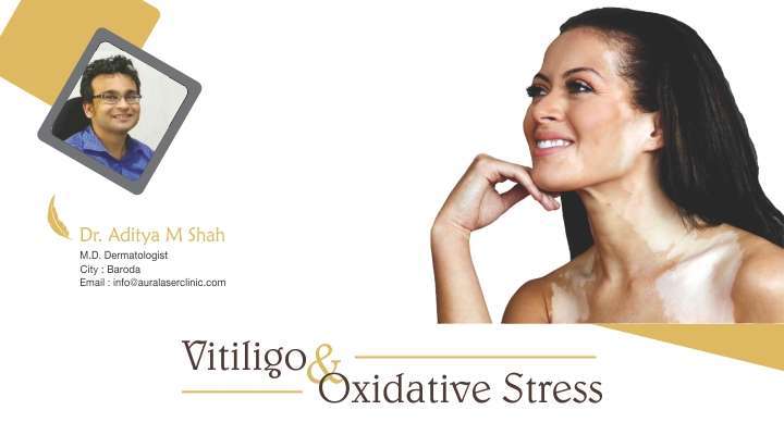 Vitiligo and Oxidative Stress