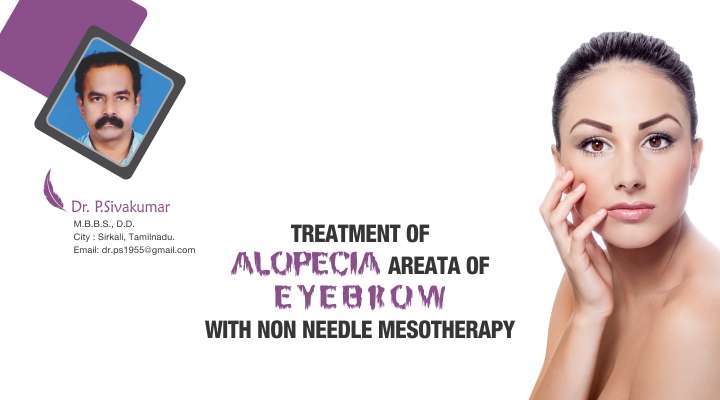 Treatment Of Alopecia Areata Of Eyebrow With Non Needle Mesotherapy