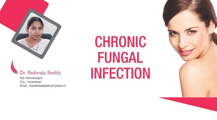 Chronic Fungal Infection