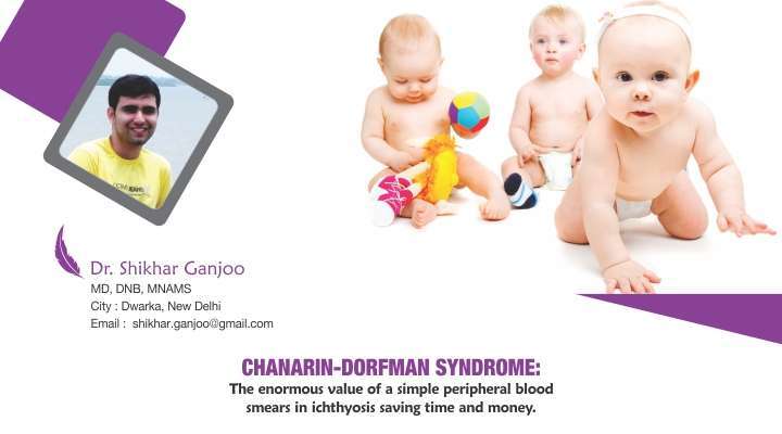 Chanarin-Dorfman Syndrome: The Enormous Value of a Simple Peripheral Blood Smears in Ichthyosis Saving Time & Money