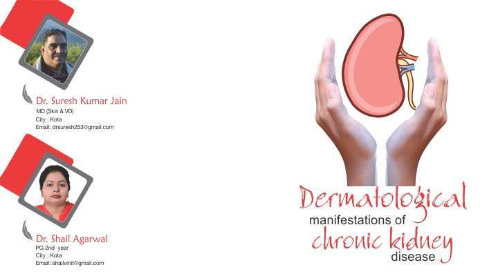 Dermatological Manifestations of Chronic Kidney Disease