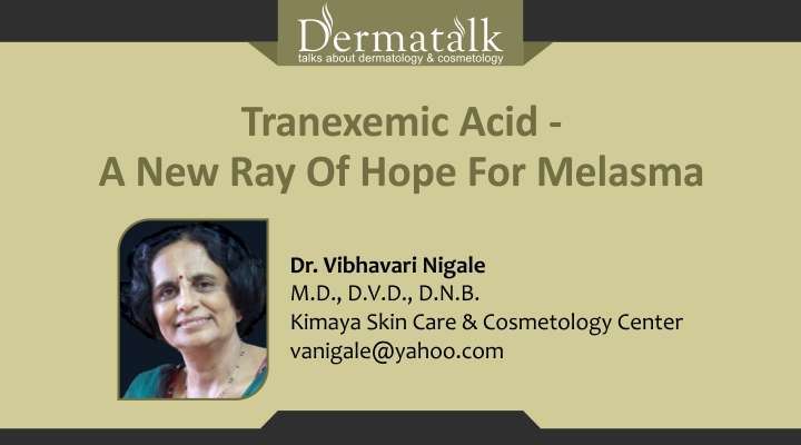 Tranexemic Acid – A New Ray of Hope for Melasma