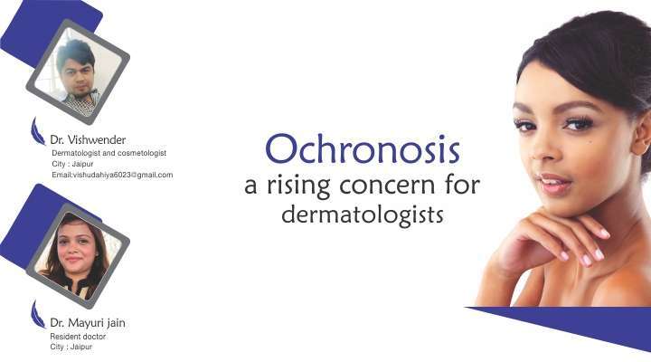 Ochronosis a Rising Concern for Dermatologists