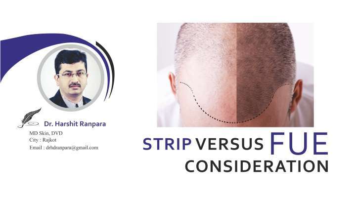 STRIP Versus FUE Consideration