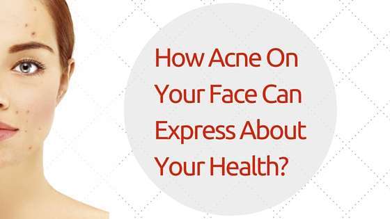 How Acne On Your Face Can Express About Your Health?