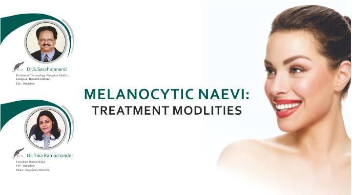 Melanocytic Naevi: Treatment Modlities