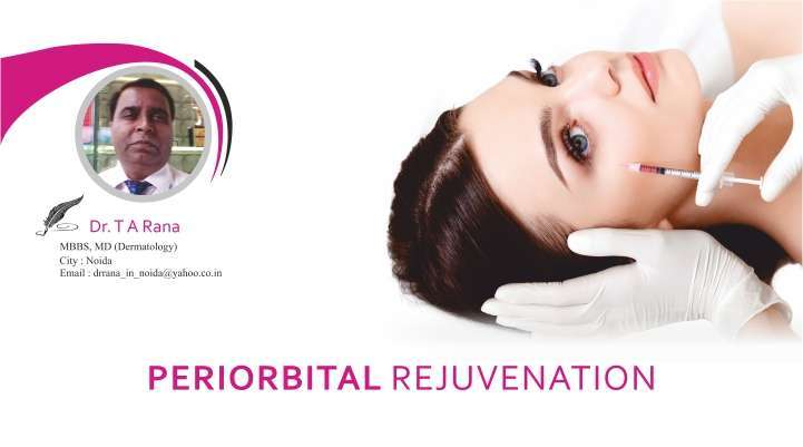 Periorbital Rejuvation