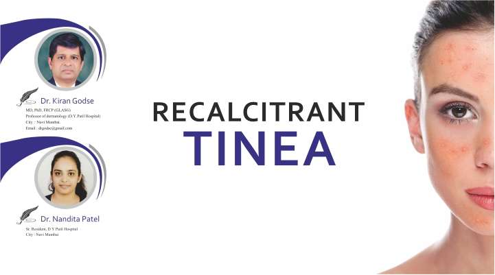 Recalcitrant Tinea