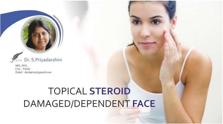 Topical Steroid Damaged/Dependent Face