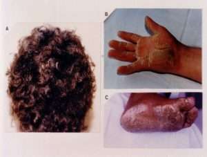 dermatalk