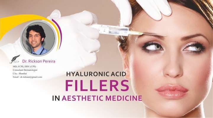Hyaluronic Acid Fillers in Aesthetic Medicine