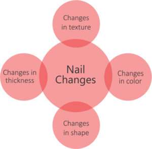 nail changes